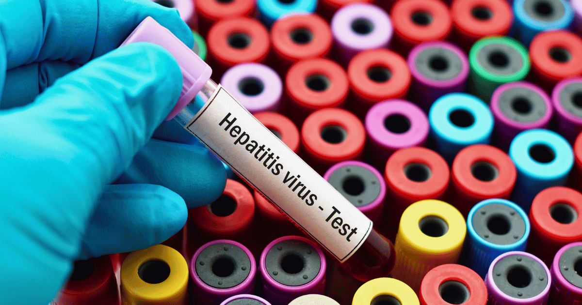 Hep-C testing vials